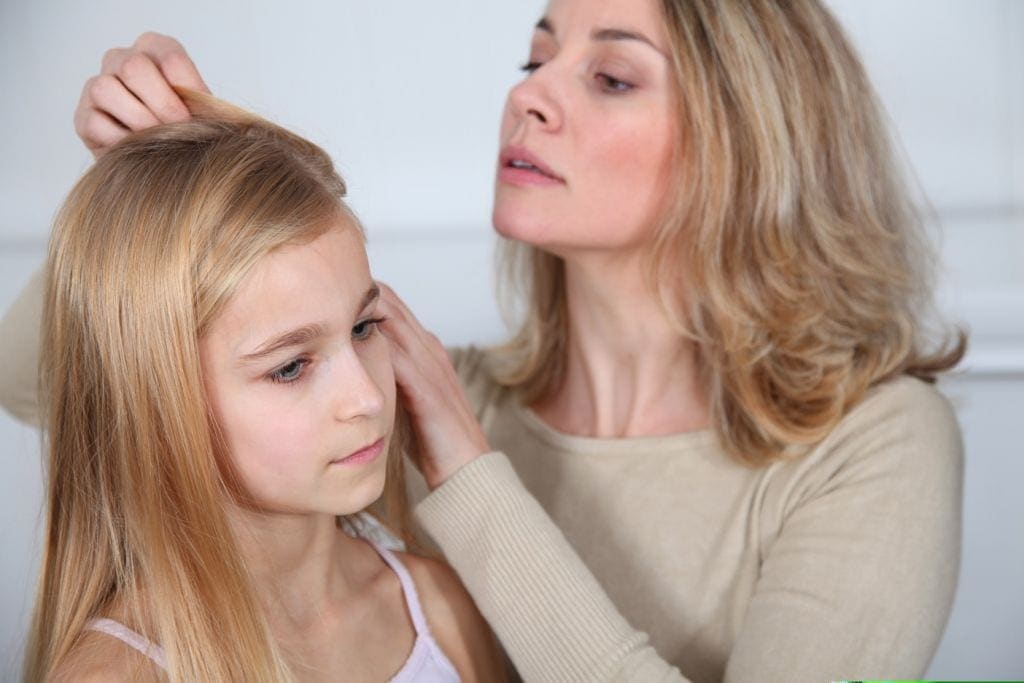head lice treatments for kids