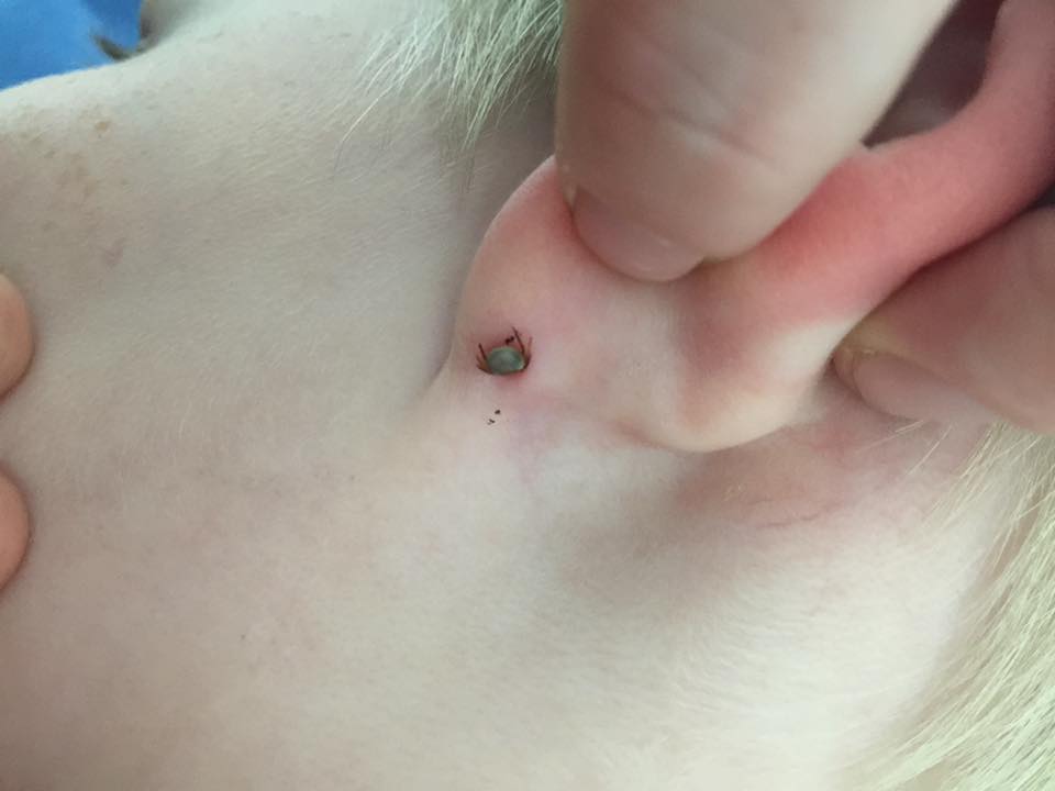 Paralysis Tick On Child's Ear